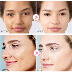 BeautySkin - Creme Facial